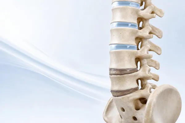 Render 3D de columna lumbar donde los discos L4-L5 y L5-S1 muestran perdida de altura y deshidratacion